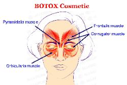 Botox treatments for the face